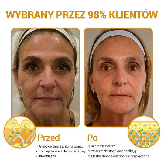 ✨Furzero™ Zaawansowany krem przeciwzmarszczkowy do ujędrniania skóry:✨ Regeneruje komórki skóry, przywracając jej elastyczność🔥