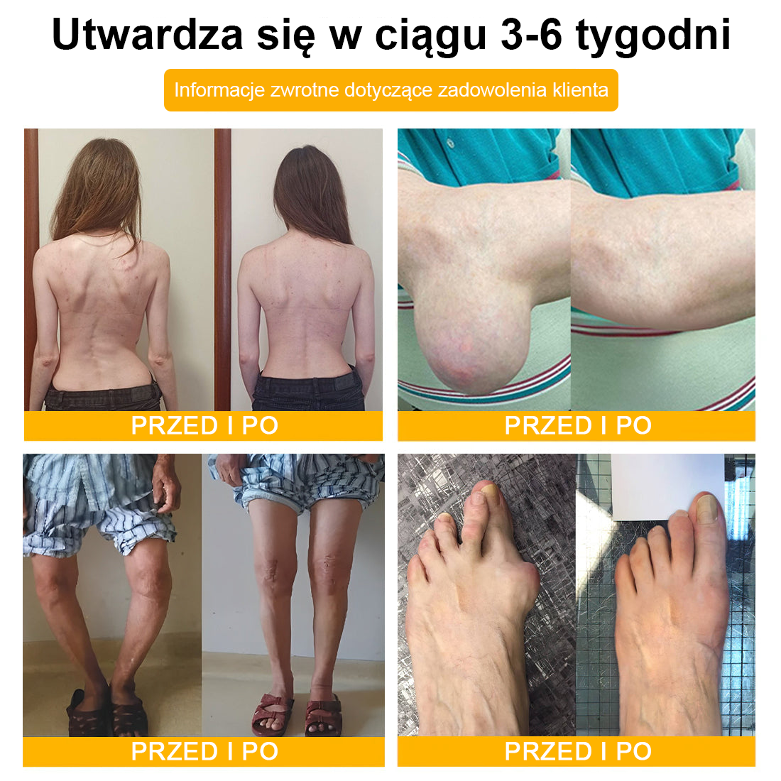 (Specjalnie dla osób starszych & polecane przez ortopedów) 🔥🔥 Krem TLOPA® z Toksyną Botulinową i Jadem Pszczelim – Przeciwbólowy i Regenerujący Kości 🐝🌿