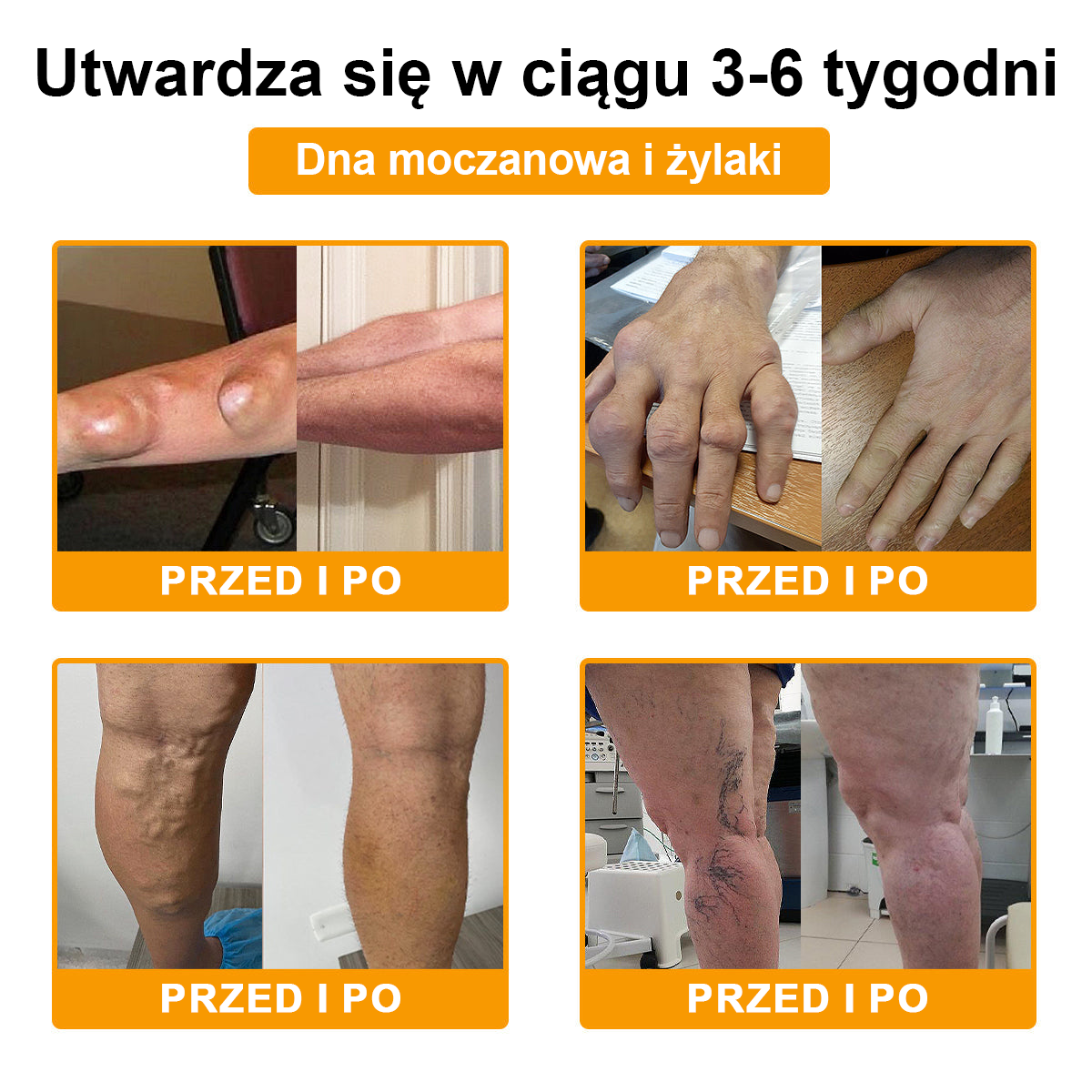 (Specjalnie dla osób starszych & polecane przez ortopedów) 🔥🔥 Krem TLOPA® z Toksyną Botulinową i Jadem Pszczelim – Przeciwbólowy i Regenerujący Kości 🐝🌿