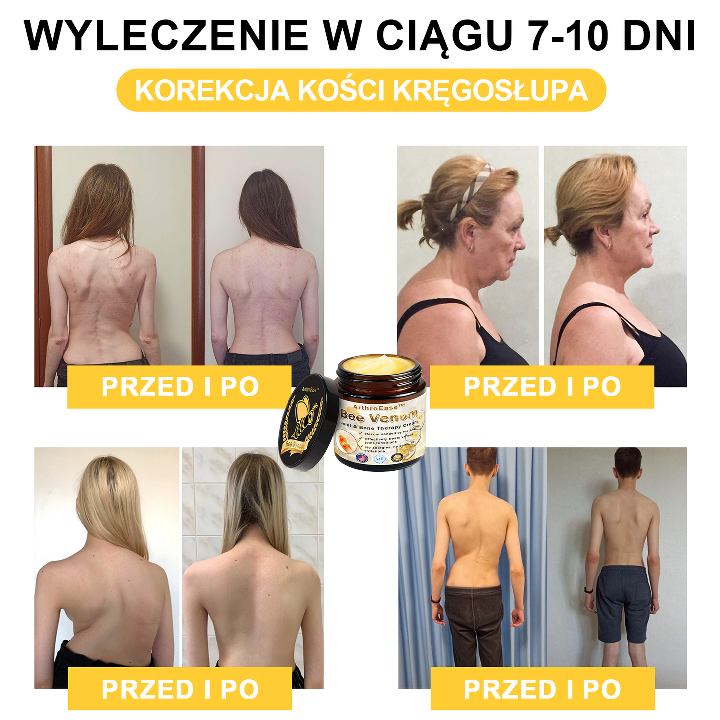 ArthroEase™ Krem z Jadem Pszczelim na Zapalenie Stawów (Szczególnie dla osób starszych, zalecany przez AAOS)🐝🎁