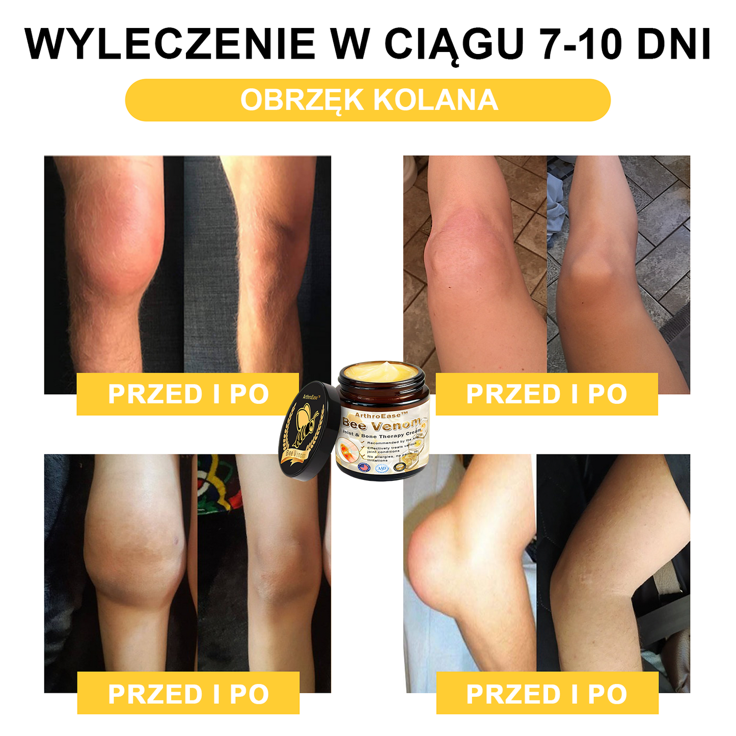 ArthroEase™ Krem z Jadem Pszczelim na Zapalenie Stawów (Szczególnie dla osób starszych, zalecany przez AAOS)🐝🎁