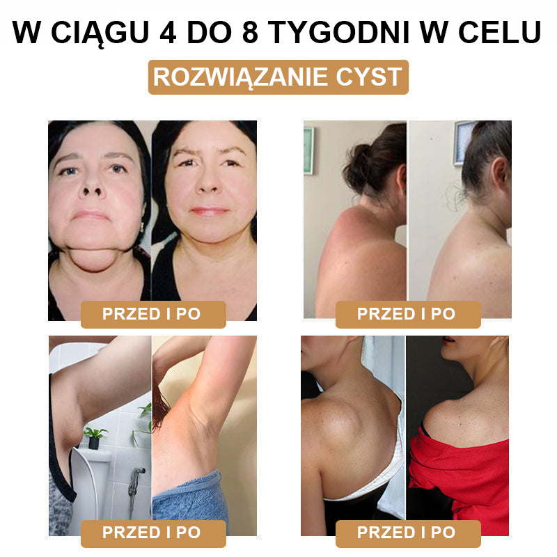 【🫧Płatność przy odbiorze🫧】Nowa bransoletka detoksykująca do liposukcji ultradźwiękowej SlimPulse™ 2025 (zalecana przez lekarza👨⚕)