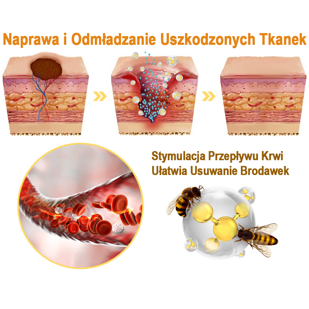 【💗płatność przy odbiorze (COD)💗】Spray do usuwania brodawek i półpaśca z jadem pszczelim (👨⚕Polecane przez AAD) 🐝(Ostatni dzień - 80% zniżki)🔥