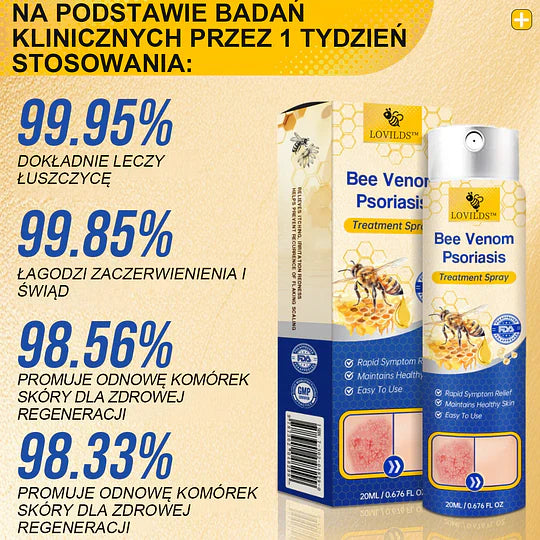 (🔥Płatność przy odbiorze🔥80% zniżki) LOVILDS™ PsoriaHeal Spray na łuszczycę (darmowa wysyłka)