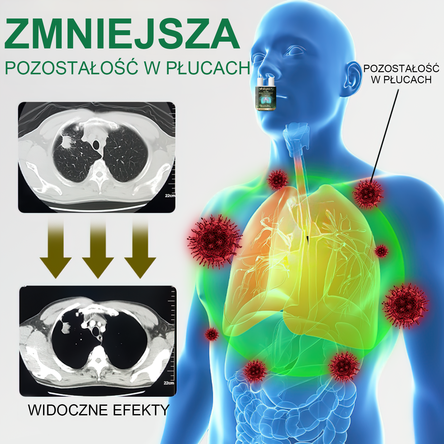 【𝐌𝐚𝐫𝐤𝐚 𝐨𝐟𝐢𝐜𝐣𝐚𝐥𝐧𝐚】👨⚕️𝐌𝐈𝐐𝐈𝐊𝐎® 𝐢𝐧𝐡𝐚𝐥𝐚𝐭𝐨𝐫 𝐝𝐨 𝐢𝐧𝐭𝐞𝐧𝐬𝐲𝐰𝐧𝐞𝐣 𝐩𝐢𝐞𝐥ę𝐠𝐧𝐚𝐜𝐣𝐢 𝐩ł𝐮𝐜【☘️𝐫𝐞𝐤𝐨𝐦𝐞𝐧𝐝𝐨𝐰𝐚𝐧𝐲 𝐩𝐫𝐳𝐞𝐳 𝐩𝐧𝐞𝐮𝐦𝐨𝐥𝐨𝐠ó𝐰☘️】