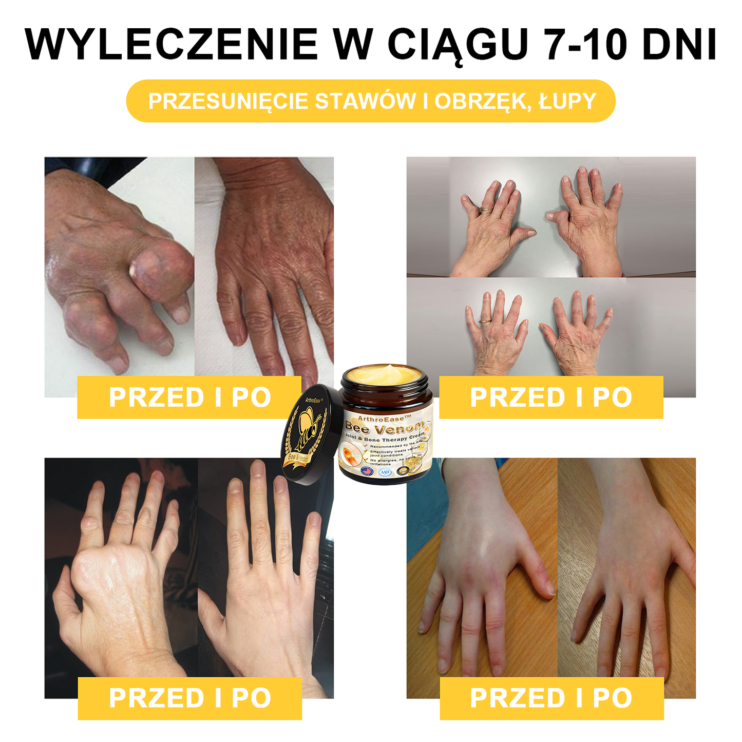 ArthroEase™ Krem z Jadem Pszczelim na Zapalenie Stawów (Szczególnie dla osób starszych, zalecany przez AAOS)🐝🎁