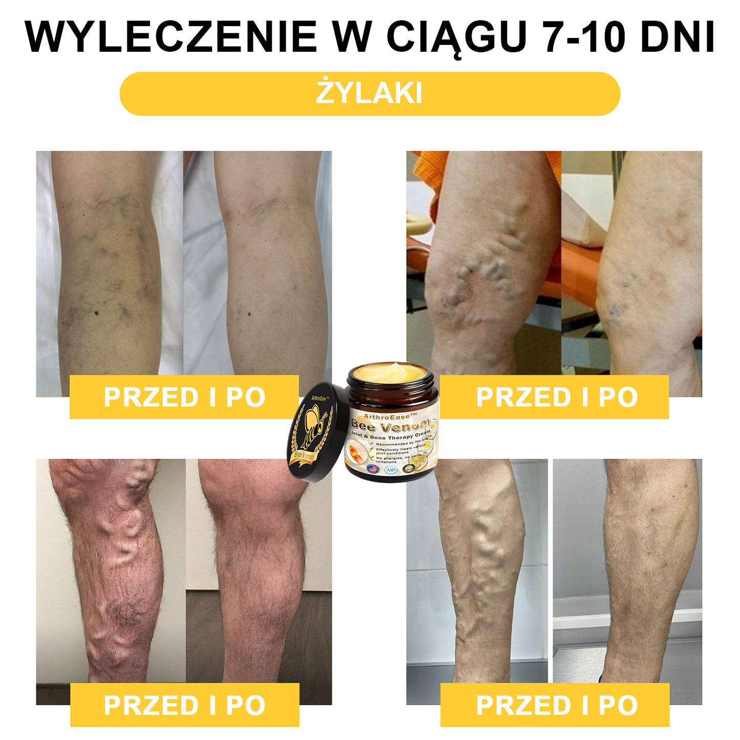 ArthroEase™ Krem z Jadem Pszczelim na Zapalenie Stawów (Szczególnie dla osób starszych, zalecany przez AAOS)🐝🎁