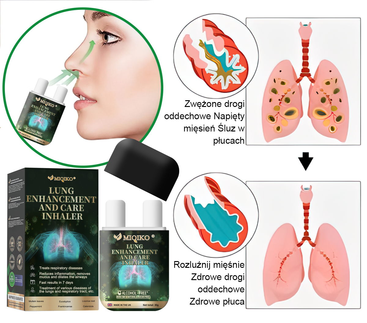 【𝐌𝐚𝐫𝐤𝐚 𝐨𝐟𝐢𝐜𝐣𝐚𝐥𝐧𝐚】👨⚕️𝐌𝐈𝐐𝐈𝐊𝐎® 𝐢𝐧𝐡𝐚𝐥𝐚𝐭𝐨𝐫 𝐝𝐨 𝐢𝐧𝐭𝐞𝐧𝐬𝐲𝐰𝐧𝐞𝐣 𝐩𝐢𝐞𝐥ę𝐠𝐧𝐚𝐜𝐣𝐢 𝐩ł𝐮𝐜【☘️𝐫𝐞𝐤𝐨𝐦𝐞𝐧𝐝𝐨𝐰𝐚𝐧𝐲 𝐩𝐫𝐳𝐞𝐳 𝐩𝐧𝐞𝐮𝐦𝐨𝐥𝐨𝐠ó𝐰☘️】