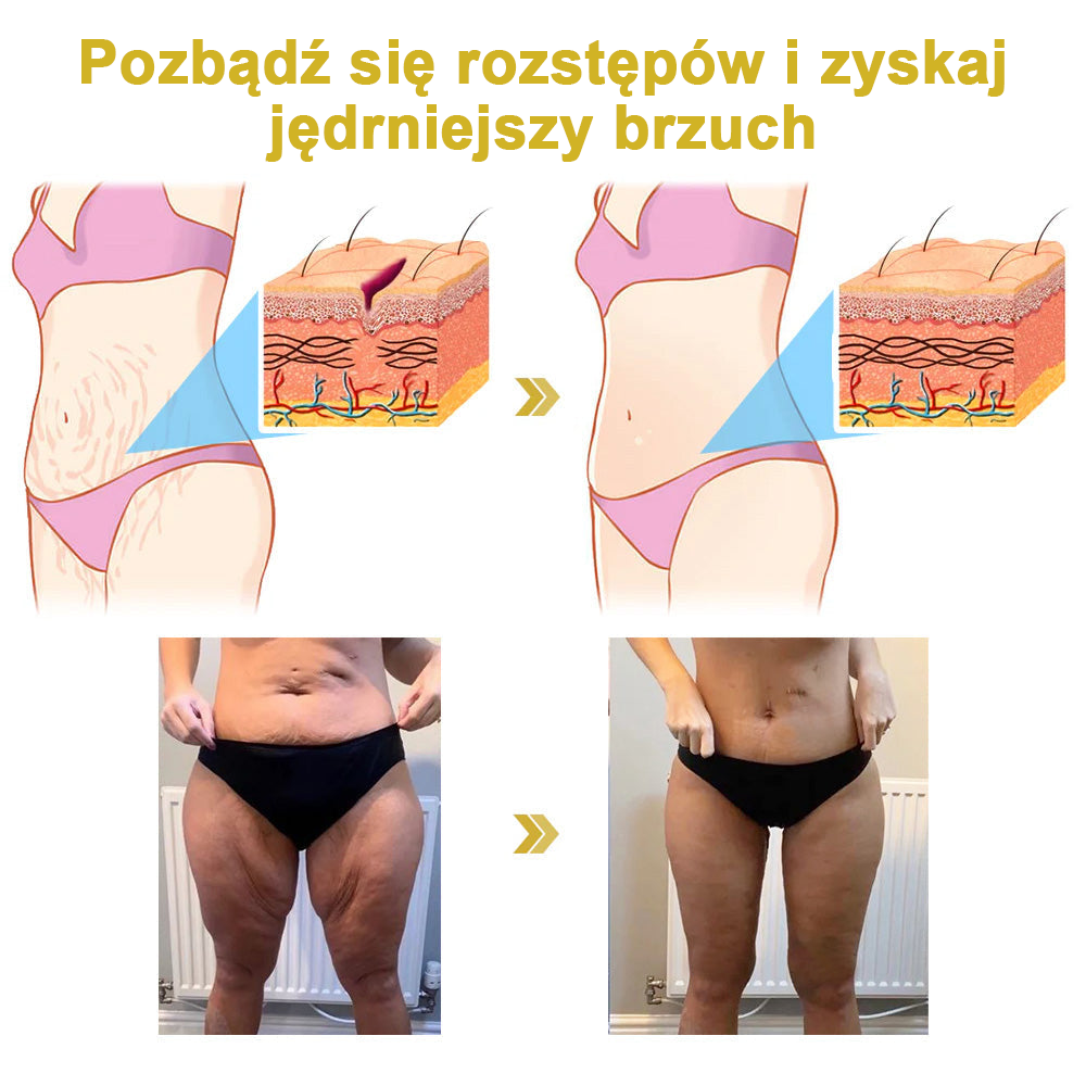 Ostatni dzień promocji: 70% zniżki - ✨Krem Ujędrniający i Odnawiający Moondar™: Przywróć Elastyczność Skóry