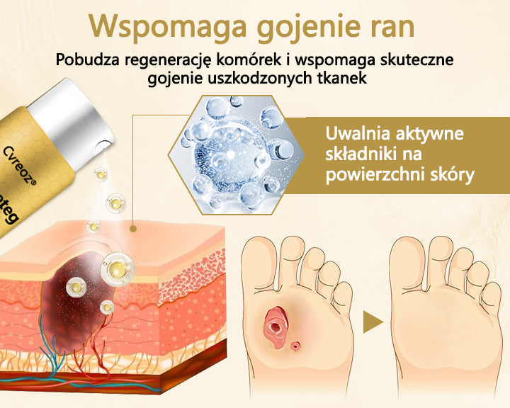 Cvreoz® Leczniczy spray do stóp cukrzycowych- zawiera jad pszczeli, który przyspiesza gojenie i zapobiega infekcjom!🌿