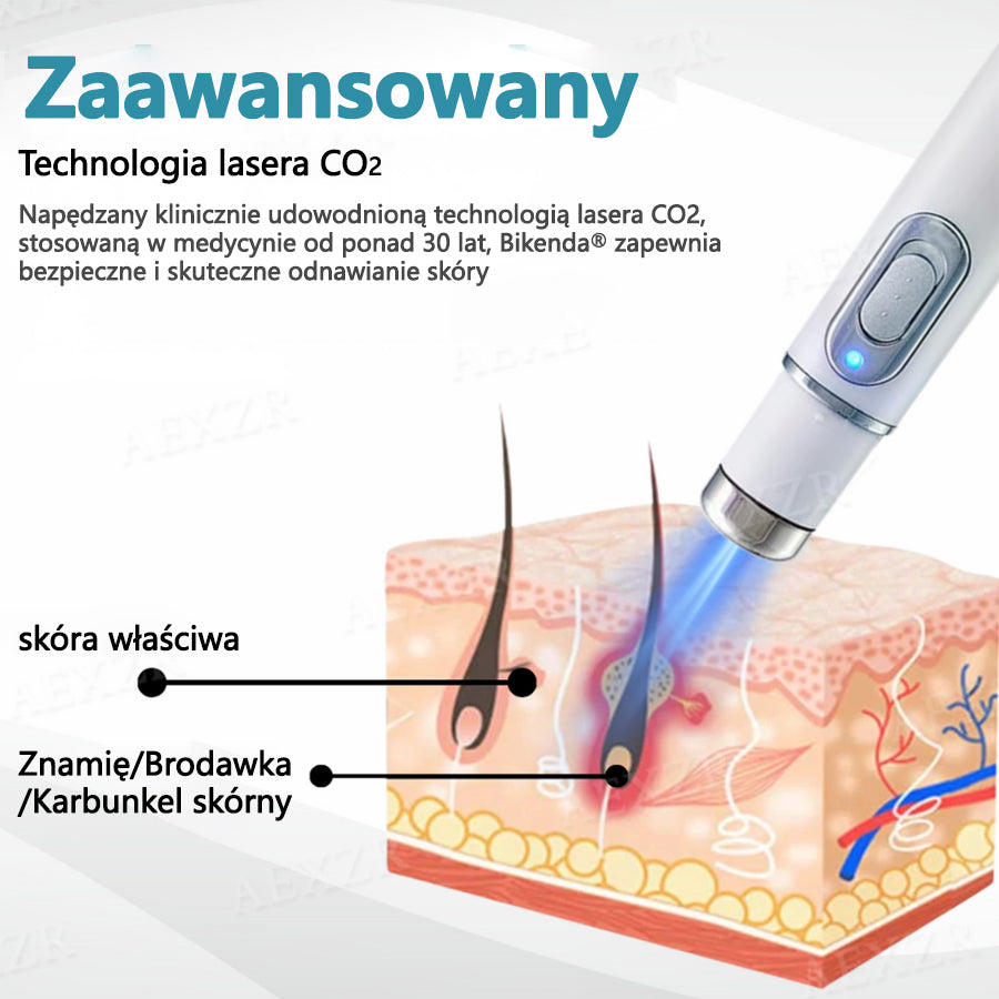 Bikenda® nieinwazyjny laserowy długopis do usuwania znamion i brodawek ✨