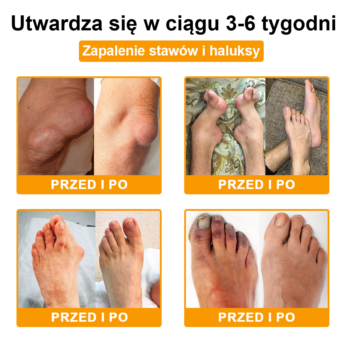 (Specjalnie dla osób starszych & polecane przez ortopedów) 🔥🔥 Krem TLOPA® z Toksyną Botulinową i Jadem Pszczelim – Przeciwbólowy i Regenerujący Kości 🐝🌿
