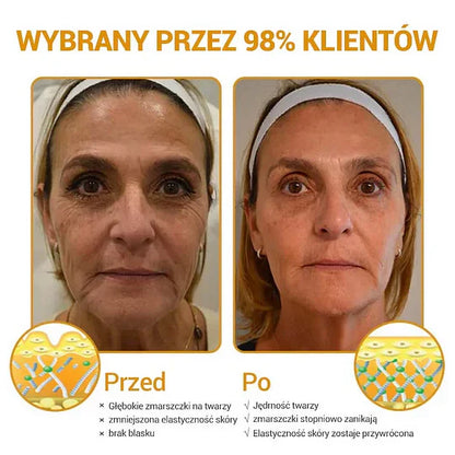 ✨Furzero™ Zaawansowany krem przeciwzmarszczkowy do ujędrniania skóry:✨ Regeneruje komórki skóry, przywracając jej elastyczność🔥
