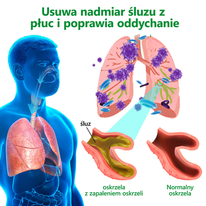 [Oficjalny sklep marki] 👨‍⚕️Lercea™ Ekskluzywny Balsam Naprawczy dla Płuc (☘️Polecany przez specjalistów od płuc☘️)