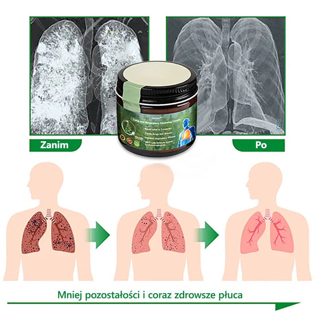 [Oficjalny sklep marki] 👨‍⚕️Lercea™ Ekskluzywny Balsam Naprawczy dla Płuc (☘️Polecany przez specjalistów od płuc☘️)
