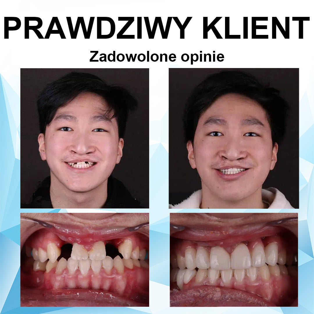 👍 [ADA Zalecane] 🌿🦷𝗦𝗺𝗶𝗹𝗲𝗵𝗽𝘆™ Zestaw do przewód protez silikonowych