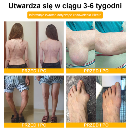 (Specjalnie dla osób starszych & polecane przez ortopedów) 🔥🔥 Krem TLOPA® z Toksyną Botulinową i Jadem Pszczelim – Przeciwbólowy i Regenerujący Kości 🐝🌿
