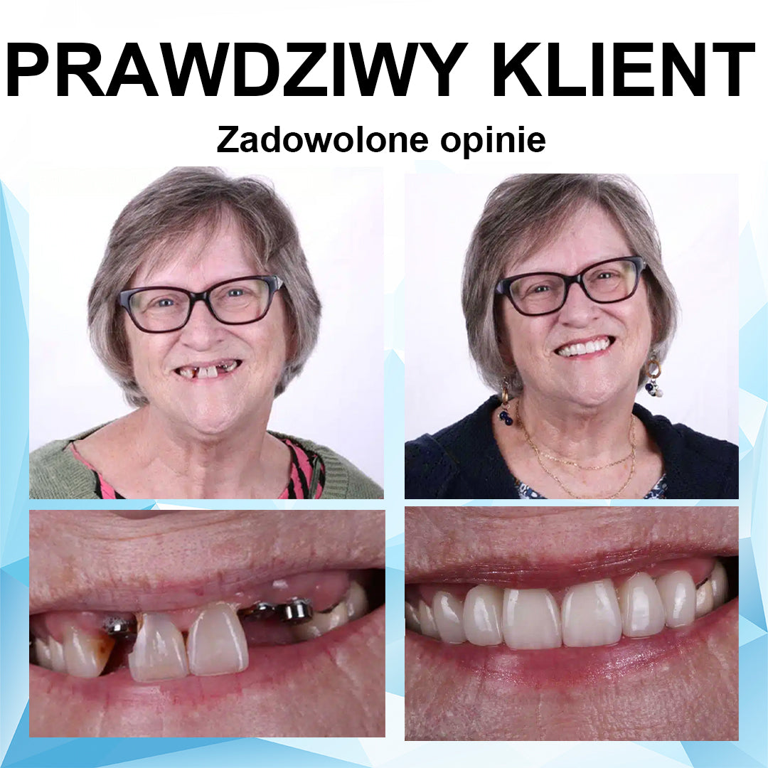 👍 [ADA Zalecane] 🌿🦷𝗦𝗺𝗶𝗹𝗲𝗵𝗽𝘆™ Zestaw do przewód protez silikonowych