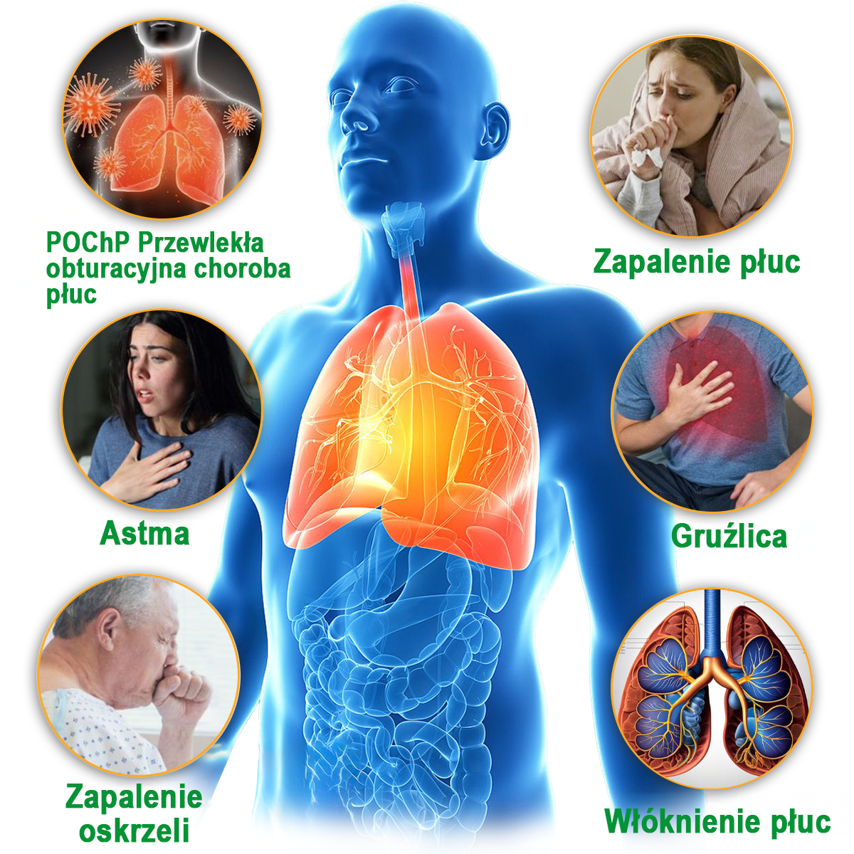 【𝐌𝐚𝐫𝐤𝐚 𝐨𝐟𝐢𝐜𝐣𝐚𝐥𝐧𝐚】👨‍⚕️𝐌𝐈𝐐𝐈𝐊𝐎® 𝐢𝐧𝐡𝐚𝐥𝐚𝐭𝐨𝐫 𝐝𝐨 𝐢𝐧𝐭𝐞𝐧𝐬𝐲𝐰𝐧𝐞𝐣 𝐩𝐢𝐞𝐥ę𝐠𝐧𝐚𝐜𝐣𝐢 𝐩ł𝐮𝐜【☘️𝐫𝐞𝐤𝐨𝐦𝐞𝐧𝐝𝐨𝐰𝐚𝐧𝐲 𝐩𝐫𝐳𝐞𝐳 𝐩𝐧𝐞𝐮𝐦𝐨𝐥𝐨𝐠ó𝐰☘️】