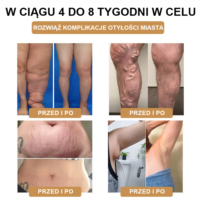 【🫧Płatność przy odbiorze🫧】Nowa bransoletka detoksykująca do liposukcji ultradźwiękowej SlimPulse™ 2025 (zalecana przez lekarza👨‍⚕)
