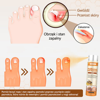 Spray z jadem pszczelim – skuteczny w leczeniu infekcji grzybiczych i zapalenia paznokci🐝