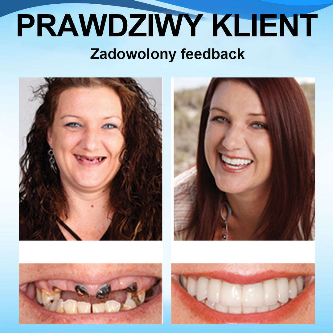 👍 [ADA Zalecane] 🌿🦷𝗦𝗺𝗶𝗹𝗲𝗵𝗽𝘆™ Zestaw do przewód protez silikonowych