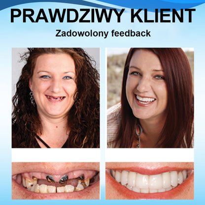 👍 [ADA Zalecane] 🌿🦷𝗦𝗺𝗶𝗹𝗲𝗵𝗽𝘆™ Zestaw do przewód protez silikonowych